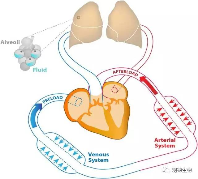 心力衰竭：心臟病患者的頭號(hào)殺手