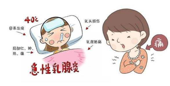 急性乳腺炎健康教育處方